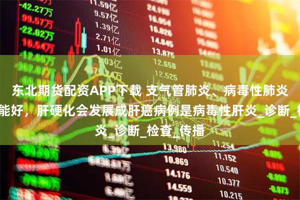 东北期货配资APP下载 支气管肺炎、病毒性肺炎输液治疗能好，肝硬化会发展成肝癌病例是病毒性肝炎_诊断_检查_传播